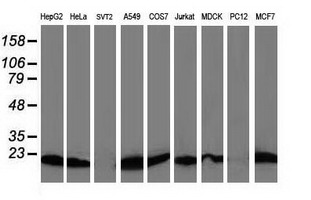 Western blot of extracts (35 ug) from 9 different cell lines by using anti-DSTN monoclonal antibody.