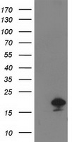 HEK293T cells were transfected with the pCMV6-ENTRY control (Left lane) or pCMV6-ENTRY DSTN (Right lane) cDNA for 48 hrs and lysed. Equivalent amounts of cell lysates (5 ug per lane) were separated by SDS-PAGE and immunoblotted with anti-DSTN.