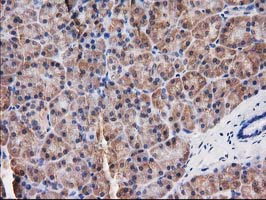 IHC of paraffin-embedded Human pancreas tissue using anti-DSTN mouse monoclonal antibody.