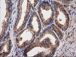 IHC of paraffin-embedded Human prostate tissue using anti-DSTN mouse monoclonal antibody.