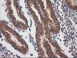 IHC of paraffin-embedded Human endometrium tissue using anti-DSTN mouse monoclonal antibody.