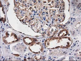 IHC of paraffin-embedded Human Kidney tissue using anti-DSTN mouse monoclonal antibody.