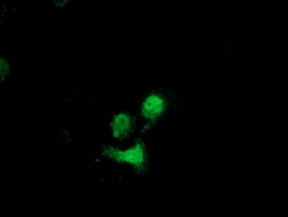 Anti-DSTN mouse monoclonal antibody immunofluorescent staining of COS7 cells transiently transfected by pCMV6-ENTRY DSTN.
