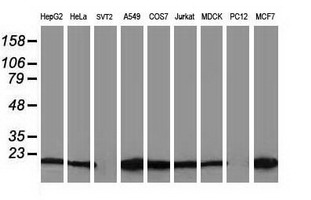 Western blot of extracts (35 ug) from 9 different cell lines by using anti-DSTN monoclonal antibody.