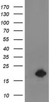 HEK293T cells were transfected with the pCMV6-ENTRY control (Left lane) or pCMV6-ENTRY DSTN (Right lane) cDNA for 48 hrs and lysed. Equivalent amounts of cell lysates (5 ug per lane) were separated by SDS-PAGE and immunoblotted with anti-DSTN.