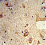 Formalin-fixed and paraffin-embedded human brain tissue reacted with DSTN Antibody , which was peroxidase-conjugated to the secondary antibody, followed by DAB staining. This data demonstrates the use of this antibody for immunohistochemistry; clinical relevance has not been evaluated.