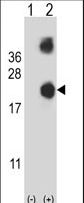 Western blot of DSTN (arrow) using rabbit polyclonal DSTN Antibody. 293 cell lysates (2 ug/lane) either nontransfected (Lane 1) or transiently transfected (Lane 2) with the DSTN gene.