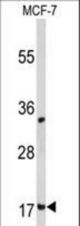 Western blot of DSTN Antibody in MCF-7 cell line lysates (35 ug/lane). DSTN (arrow) was detected using the purified antibody.