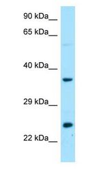 DTD1 antibody Western Blot of Fetal Liver.
