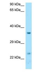 DTD1 antibody Western Blot of Fetal Liver.