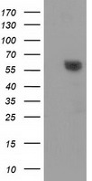 HEK293T cells were transfected with the pCMV6-ENTRY control (Left lane) or pCMV6-ENTRY DTNA (Right lane) cDNA for 48 hrs and lysed. Equivalent amounts of cell lysates (5 ug per lane) were separated by SDS-PAGE and immunoblotted with anti-DTNA.