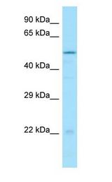 DTNA / Dystrobrevin Alpha antibody Western Blot of HeLa.
