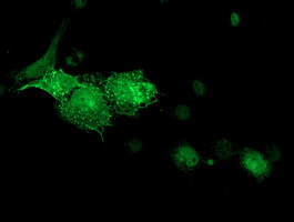 Anti-DTNA mouse monoclonal antibody immunofluorescent staining of COS7 cells transiently transfected by pCMV6-ENTRY DTNA.