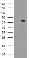 HEK293T cells were transfected with the pCMV6-ENTRY control (Left lane) or pCMV6-ENTRY DTNA (Right lane) cDNA for 48 hrs and lysed. Equivalent amounts of cell lysates (5 ug per lane) were separated by SDS-PAGE and immunoblotted with anti-DTNA.