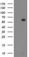 HEK293T cells were transfected with the pCMV6-ENTRY control (Left lane) or pCMV6-ENTRY DTNA (Right lane) cDNA for 48 hrs and lysed. Equivalent amounts of cell lysates (5 ug per lane) were separated by SDS-PAGE and immunoblotted with anti-DTNA.