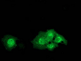 Anti-DTNA mouse monoclonal antibody immunofluorescent staining of COS7 cells transiently transfected by pCMV6-ENTRY DTNA.