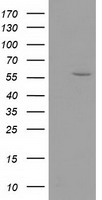 HEK293T cells were transfected with the pCMV6-ENTRY control (Left lane) or pCMV6-ENTRY DTNA (Right lane) cDNA for 48 hrs and lysed. Equivalent amounts of cell lysates (5 ug per lane) were separated by SDS-PAGE and immunoblotted with anti-DTNA.