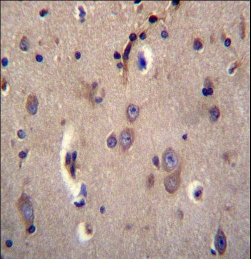 DTNA Antibody immunohistochemistry of formalin-fixed and paraffin-embedded human brain tissue followed by peroxidase-conjugated secondary antibody and DAB staining.