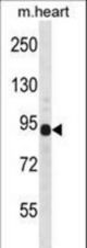 DTNA Antibody western blot of mouse heart tissue lysates (35 ug/lane). The DTNA antibody detected the DTNA protein (arrow).
