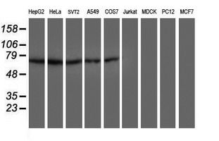 Western blot of extracts (35 ug) from 9 different cell lines by using anti-DTNB monoclonal antibody.