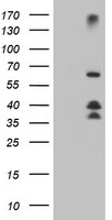 HEK293T cells were transfected with the pCMV6-ENTRY control (Left lane) or pCMV6-ENTRY DTNB (Right lane) cDNA for 48 hrs and lysed. Equivalent amounts of cell lysates (5 ug per lane) were separated by SDS-PAGE and immunoblotted with anti-DTNB.