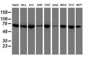 Western blot of extracts (35 ug) from 9 different cell lines by using anti-DTNB monoclonal antibody.
