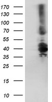 HEK293T cells were transfected with the pCMV6-ENTRY control (Left lane) or pCMV6-ENTRY DTNB (Right lane) cDNA for 48 hrs and lysed. Equivalent amounts of cell lysates (5 ug per lane) were separated by SDS-PAGE and immunoblotted with anti-DTNB.