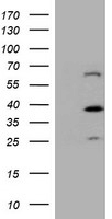 HEK293T cells were transfected with the pCMV6-ENTRY control (Left lane) or pCMV6-ENTRY DTNB (Right lane) cDNA for 48 hrs and lysed. Equivalent amounts of cell lysates (5 ug per lane) were separated by SDS-PAGE and immunoblotted with anti-DTNB.