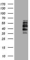 HEK293T cells were transfected with the pCMV6-ENTRY control (Left lane) or pCMV6-ENTRY DTNB (Right lane) cDNA for 48 hrs and lysed. Equivalent amounts of cell lysates (5 ug per lane) were separated by SDS-PAGE and immunoblotted with anti-DTNB.