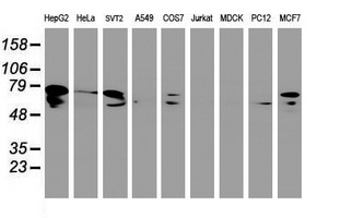 Western blot of extracts (35ug) from 9 different cell lines by using anti-DTNB monoclonal antibody.