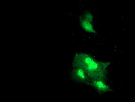 Anti-DTNB mouse monoclonal antibody immunofluorescent staining of COS7 cells transiently transfected by pCMV6-ENTRY DTNB.