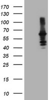 HEK293T cells were transfected with the pCMV6-ENTRY control (Left lane) or pCMV6-ENTRY DTNB (Right lane) cDNA for 48 hrs and lysed. Equivalent amounts of cell lysates (5 ug per lane) were separated by SDS-PAGE and immunoblotted with anti-DTNB.
