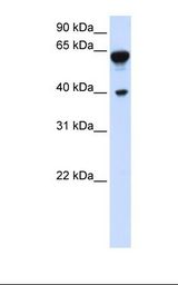 Transfected 293T cell lysate. Antibody concentration: 1.0 ug/ml. Gel concentration: 12%.