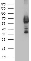 HEK293T cells were transfected with the pCMV6-ENTRY control (Left lane) or pCMV6-ENTRY DTNB (Right lane) cDNA for 48 hrs and lysed. Equivalent amounts of cell lysates (5 ug per lane) were separated by SDS-PAGE and immunoblotted with anti-DTNB.