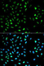 Immunofluorescence analysis of MCF7 cell using DTNBP1 antibody. Blue: DAPI for nuclear staining.