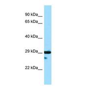Western blot of Human HepG2. DTNBP1 antibody dilution 1.0 ug/ml.