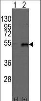 Western blot of Dtnbp1(arrow) using rabbit polyclonal Dysbindin(Dtnbp1) Antibody. 293 cell lysates (2 ug/lane) either nontransfected (Lane 1) or transiently transfected with the Dtnbp1 gene (Lane 2) (Origene Technologies).
