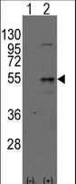 Western blot of Dtnbpt(arrow) using rabbit polyclonal Dysbindin(Dtnbp1) Antibody. 293 cell lysates (2 ug/lane) either nontransfected (Lane 1) or transiently transfected with the Dtnbpt gene (Lane 2) (Origene Technologies).