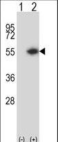 Western blot of DTNBP1 (arrow) using rabbit polyclonal DTNBP1 Antibody. 293 cell lysates (2 ug/lane) either nontransfected (Lane 1) or transiently transfected (Lane 2) with the DTNBP1 gene.