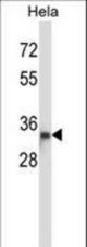 DTNBP1 Antibody western blot of HeLa cell line lysates (35 ug/lane). The DTNBP1 antibody detected the DTNBP1 protein (arrow).