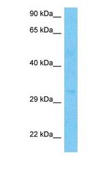 Western blot of DTWD1 Antibody with human large intestine Tumor lysate.