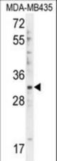 DTWD1 Antibody western blot of MDA-MB435 cell line lysates (35 ug/lane). The DTWD1 antibody detected the DTWD1 protein (arrow).