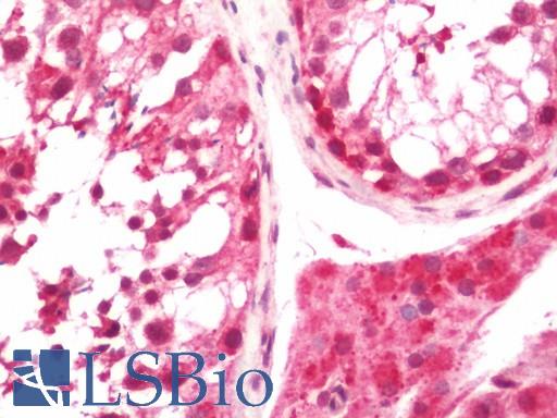 Human Testis: Formalin-Fixed, Paraffin-Embedded (FFPE)