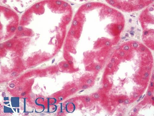 Human Kidney: Formalin-Fixed, Paraffin-Embedded (FFPE)