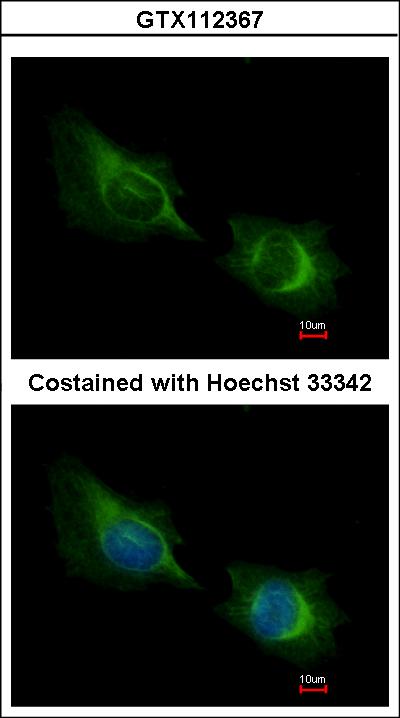 Immunofluorescence of methanol-fixed HeLa using Deltex1 antibody at 1:200 dilution.