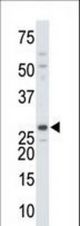 The anti-DTYMK antibody is used in Western blot to detect DTYMK in mouse colon tissue lysate.