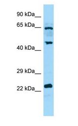 DUSP14 antibody Western Blot of Placenta.