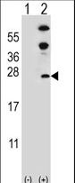 Western blot of DUSP14 (arrow) using rabbit polyclonal DUSP14 Antibody (D183). 293 cell lysates (2 ug/lane) either nontransfected (Lane 1) or transiently transfected (Lane 2) with the DUSP14 gene.