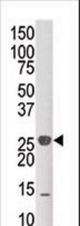 Western blot of anti-DUSP14 antibody in mouse kidney tissue lysate (35 ug/lane). DUSP14(arrow) was detected using the purified antibody.