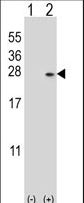 Western blot of DUSP14 (arrow) using rabbit polyclonal DUSP14 Antibody (M1). 293 cell lysates (2 ug/lane) either nontransfected (Lane 1) or transiently transfected (Lane 2) with the DUSP14 gene.